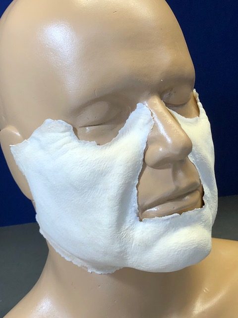 Fat Cheeks and Chin-Foam Latex Prosthetic